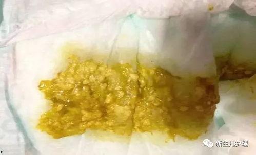 小宝宝吃贝贝瓜便秘吗