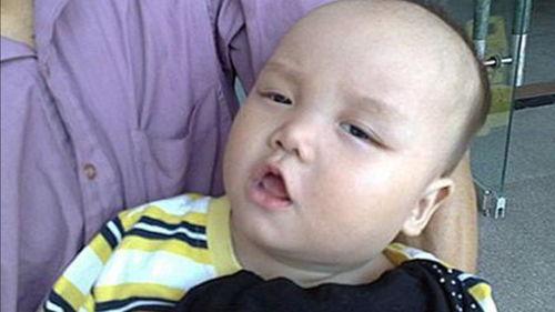 吃瓜没洗舌头疼,揭秘口腔健康小常识